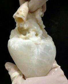 قلب انسان پس از تخلیه کامل خون